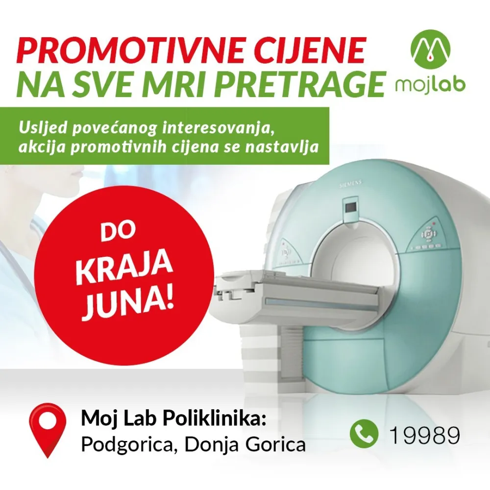 Promotivne cijene na MRI pretrage