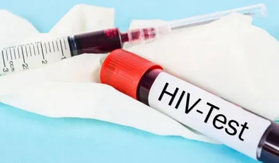 Бесплатно тестирање у ИЈЗ