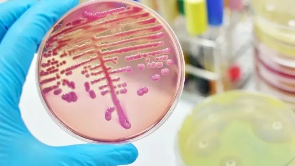 Razvijen novi način uni&scaron;tavanja bakterija otpornih na antibiotike