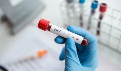 HIV otkriven kod jednog dobrovoljnog davaoca krvi