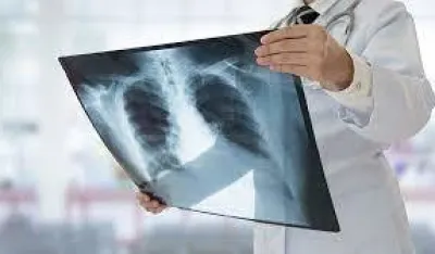 Borbu sa kancerom godi&scaron;nje izgubi 2.000 osoba