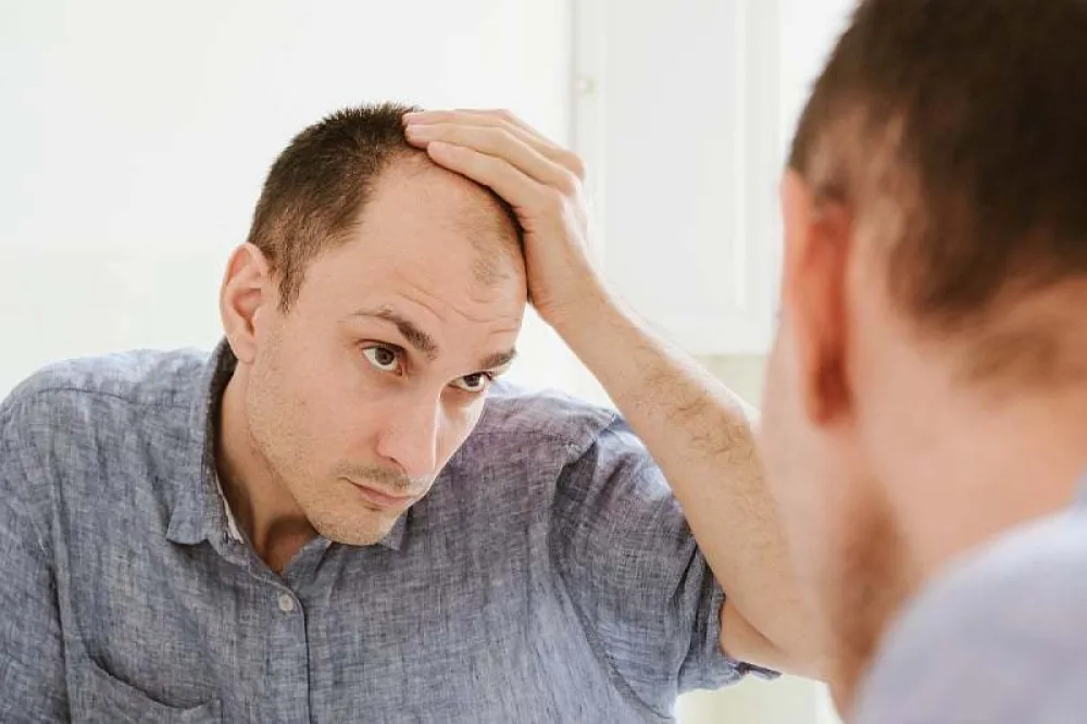 Opada vam kosa? Isprobajte test koji otkriva u čemu je tačno problem