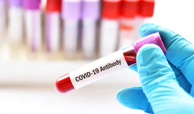 Progla&scaron;en prestanak epidemije kovida 19 na teritoriji Srbije