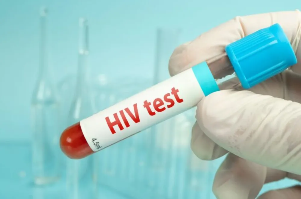 Sjutra besplatno testiranje na HIV