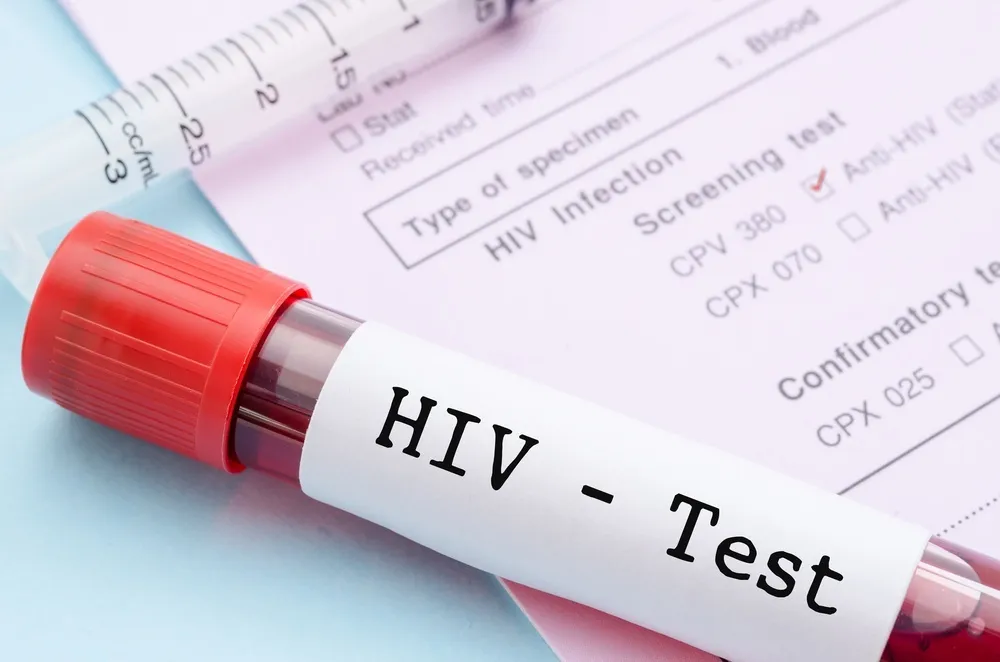 Istraživači u Belgiji razvili metod koji bi virus HIV mogao da učini trajno bezopasnim
