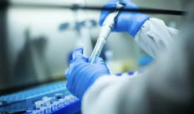Tečna biopsija: Nova tehnologija za otkrivanje raka
