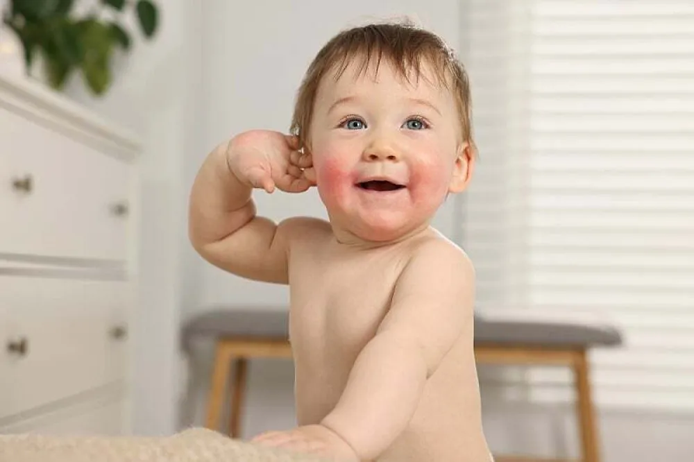 Kako prepoznati i ublažiti atopijski dermatitis kod beba