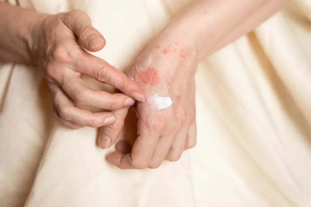 Ovo su rani znakovi nedostatka vitamina C koje ne biste trebali ignorisati