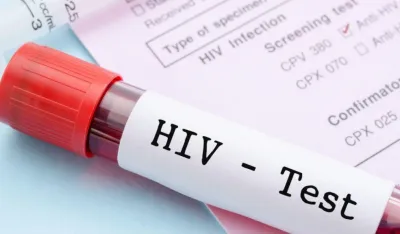 Izvje&scaron;taj SZO: Infekcije HIV-om u Evropi često se otkrivaju prekasno