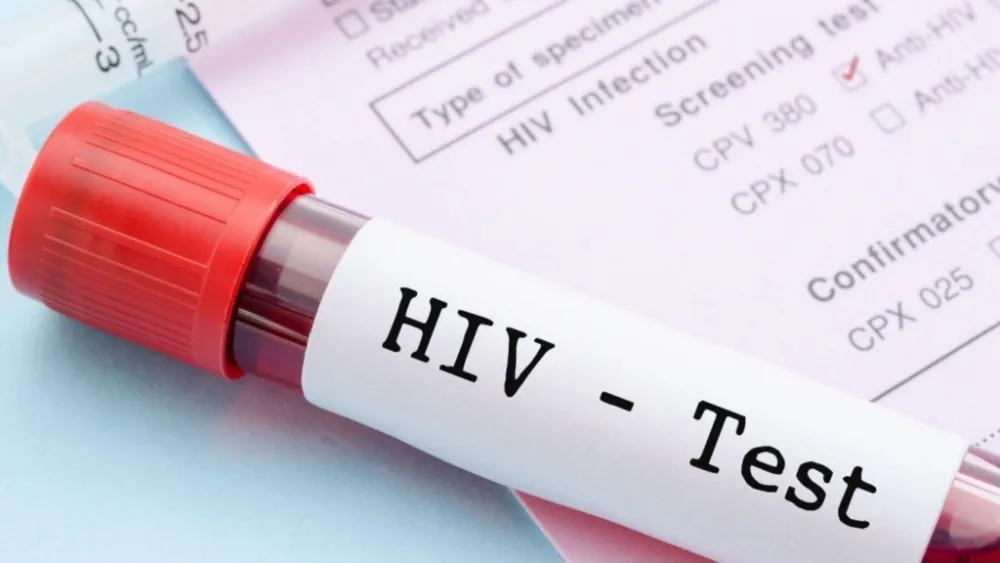 Izvje&scaron;taj SZO: Infekcije HIV-om u Evropi često se otkrivaju prekasno