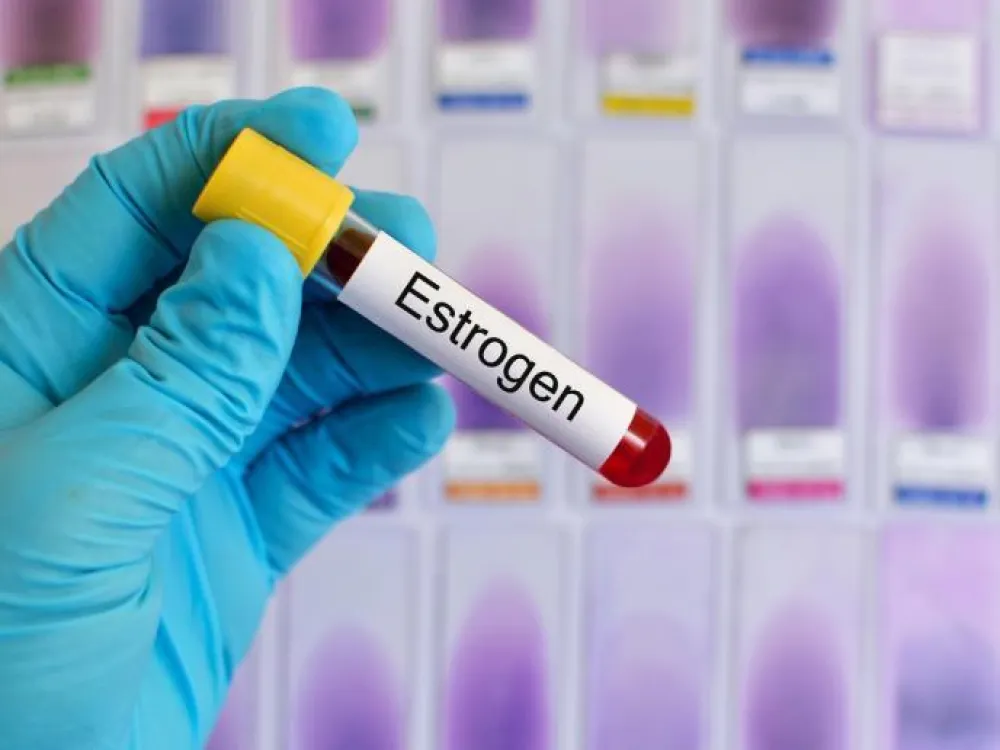 Nizak estrogen &ndash; tihi uzrok brojnih tegoba