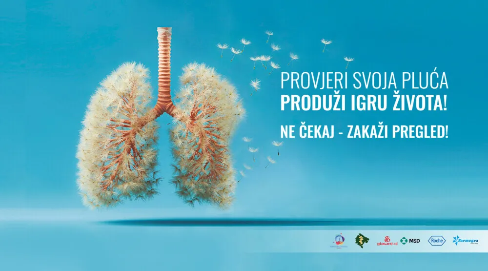 Kampanja podizanja svijesti o prevenciji karcinoma pluća: U Crnoj Gori svake godine vi&scaron;e od 300 novih slučajeva