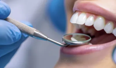 Rusi sproveli veliku studiju: Ovaj vitamin je ključan za zubnu implantaciju