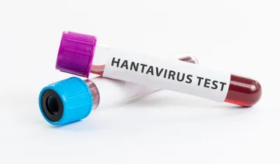 U Crnoj Gori 44 slučaja hantavirusa u posljednjih deset godina