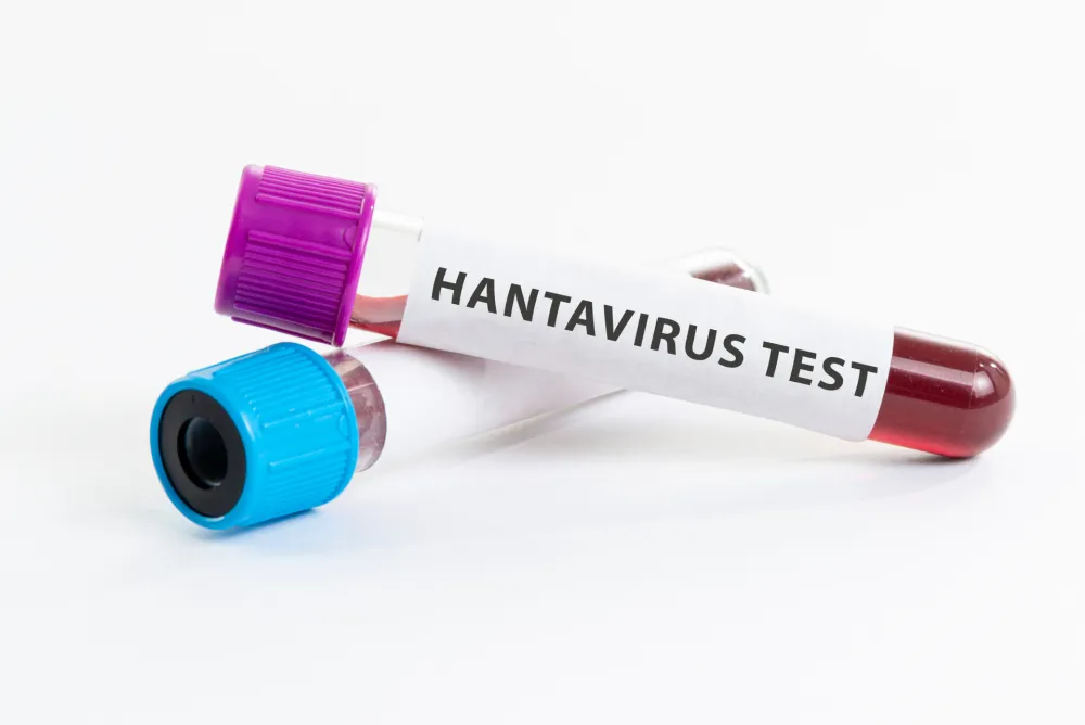 U Crnoj Gori 44 slučaja hantavirusa u posljednjih deset godina